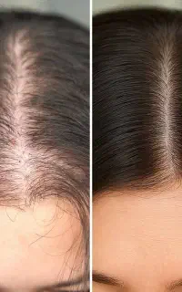 این آخرین روش که امتحان میکنی