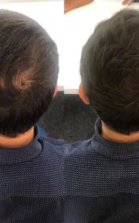جز این راه دیگه ای نداری برای موهات