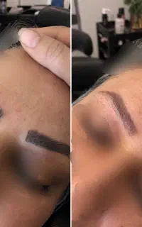 فیبروز ابرو