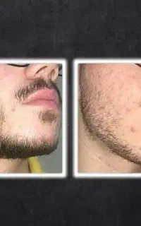 سیبیل ترکی میخوایی خوراکش اینجاست ، پیام بده
