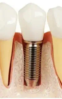 دندان پزشکی