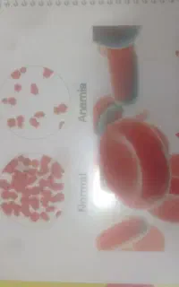 جزوه ارشد وزارت بهداشت هماتولوژی