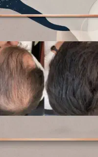محافظ لنز رویش