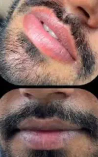 بازگشت رنگ طبیعی لب /تضمینی