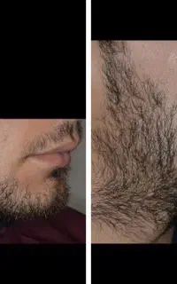 فرقو نگاه کن دوست داری تو هم ریشت در بیاد