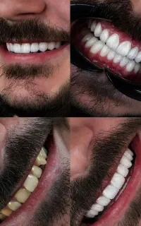 موبایل