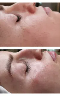 فیشال ،پاکسازی و خالبرداری
