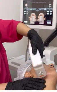 هایفوتراپی ، معجزه ی جوانسازی بدون تیغ جراحی