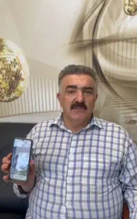 کاشت مو و ابرو وسلیل