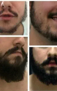 رویش. و حجم. آوری با محلول ۳۰روزه
