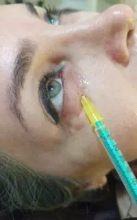 آموزش ژل وبوتاکس و خدمات