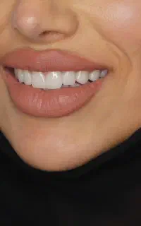 دندانپزشکی لبخند(با اقساط ۶۰ ماهه)
