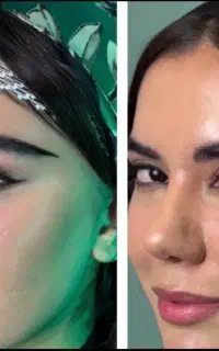 کاشت مو ابرو ریش