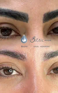آموزش و خدمات حرفه ای ریموو تتو