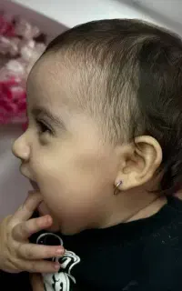 سوراخ کردن گوش کودک و نوزاد