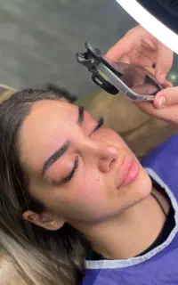 فیبروز حرفه ای