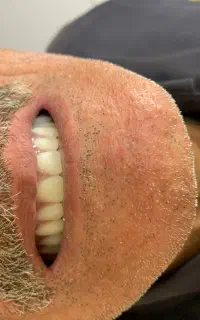 دندانسازی رز دنت شعبه اصلی تربت حیدریه ودوم مشهد