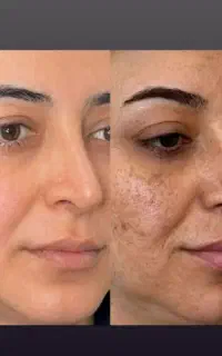 تیرگی هاتو از بین ببر