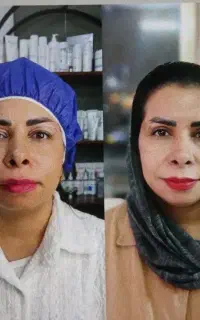 جراحی بلفارو با قیمت باور نکردنی