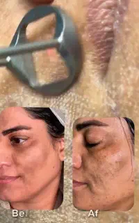جوانسازی صورت و رفع تیرگی بدن