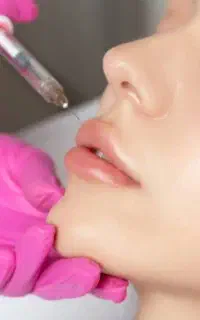 مدل برای ژل و بوتاکس