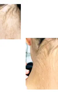 درمان ریشه ای و تخصصی پیسی
