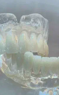 دندانسازی دندان مصنوعی