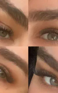 کاشت مژه هیدن