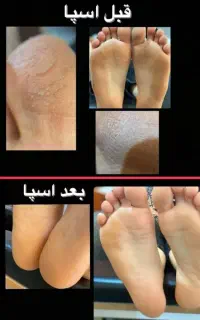 اسپا تخصصی دست و پا