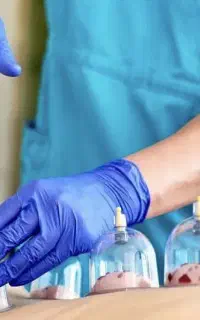 حس و حال خوب با حجامت در بهترین فصل آن
