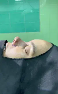 جراحی بینی با کیفیت ،قیمت مناسب