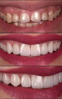 دندان پزشکی اقساطی