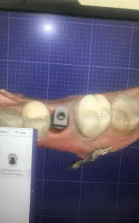 لابراتوار دندانسازی