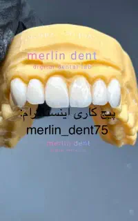 قبول انواع پرسلن گذاری ساده ولیرینگ ازاپک تاگلیز