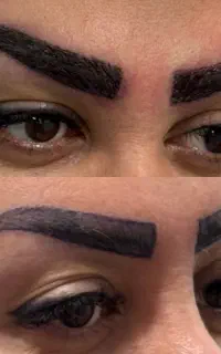 کاشت ابرو سوپر طبیعی