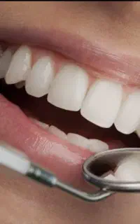 لابراتوار دندانسازی(دندان مصنوعی)