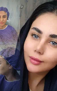 جراحی بینی در تهران/شرایط ویژه برای مراجعین دهدشت