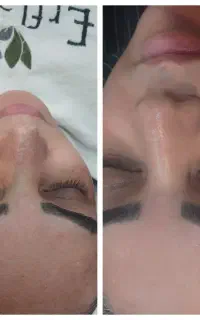 فیشال و پاکسازی با قیمت اقتصادی فقط برای ۵ نفر
