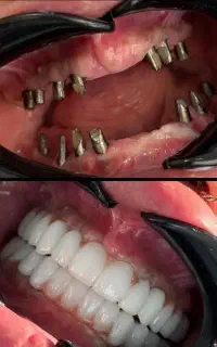 جشنواره شرایط اقساطی ‌بلند‌مدت پزشکی ایمپلنت
