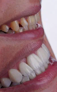 انجام تمامی خدمات دندان پزشکی تخصصی با اقساط
