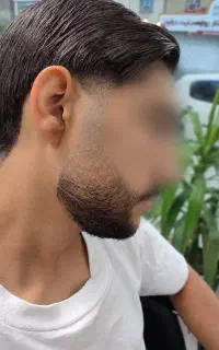 هر اسلاح پاکسازی صورت رایگان