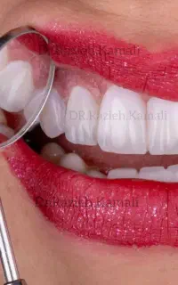 دندانپزشکی اقساطی در فلاورجان و اصفهان