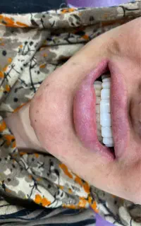 آموزش کامپوزیت