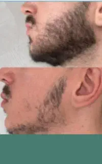 چهره ات رو مردونه کن