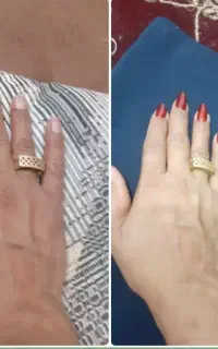 ک ر م vip سفیدکننده ضدلک