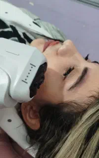 لیزر موهای زائد