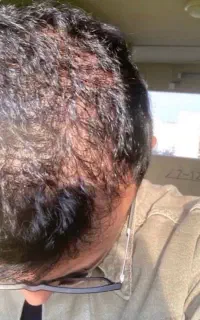 نزار کف سرت مثل کف دستت بشه