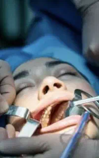 عمل لوزه توسط پزشک متخصص