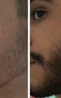 قطعا ریش نشونه مردونگیه