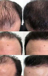 نتیجه باور نکردنی